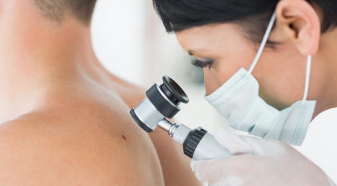 Melanoma – kockázati tényezők és figyelmeztető jelek Melanoma - kockázati tényezők és figyelmeztető jelek